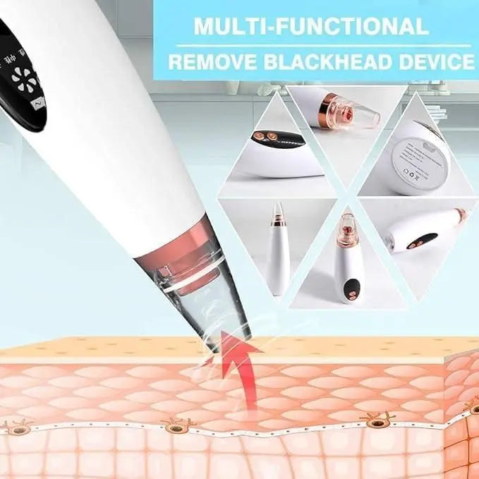 6 in 1 Multi-function Blackhead Remover Tools - ULLLY