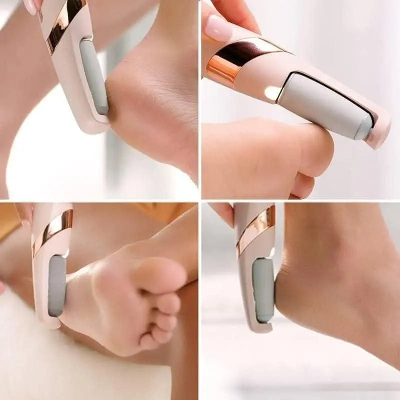 Electronic Cordless Pedicure Callus Dead Skin Remover Polishing Tool - ULLLY